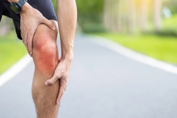 A Comprehensive Guide on Patellofemoral Pain Syndrome Causes and Symptoms
