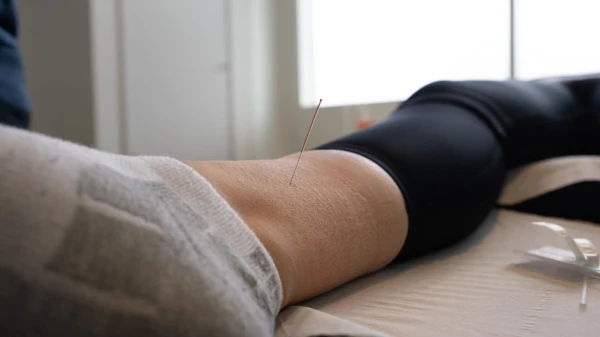 Acupuncture for diabetes