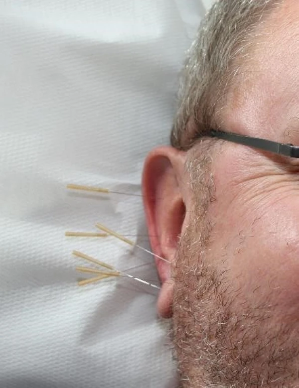 Needles in your ear can help your health...
