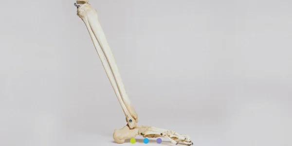 Osteoporosis training - Management and Prevention