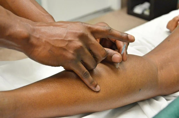 The effects of dry needling/acupuncture on muscle pain