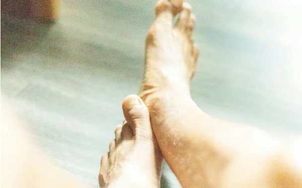 What are calluses and how are they treated?