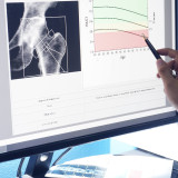 Bone density screening